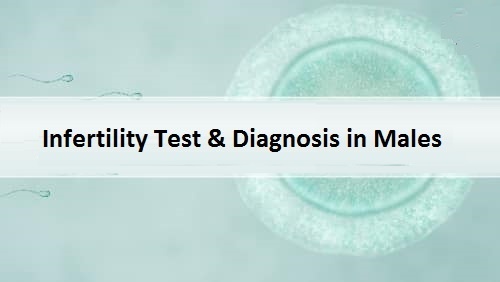 Infertility Diagnosis in Males
