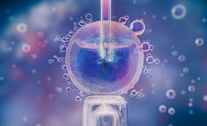 PGT-A in IVF