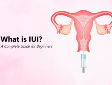 What Is IUI